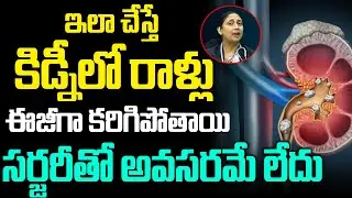 Precautions For Kidney Stones in Telugu | Kidney Stone Treatment #healthtipsintelugu | Cloud Health