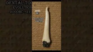 Dental Tools Evolution (2000 BC &ndash; 2100 AD) | A Visual Timeline #evolution #trend #timelapse #dental