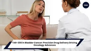 TAR-200 in Bladder Cancer: Precision Drug Delivery Driving Oncology Advances