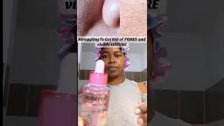 Struggling with Pores & Texture? This Serum Surprised Me✨ #shorts