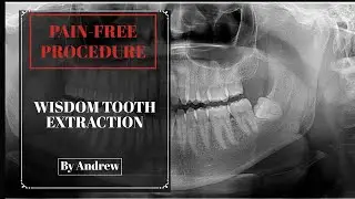 Wisdom Tooth Extraction | Progressive House | Andrew