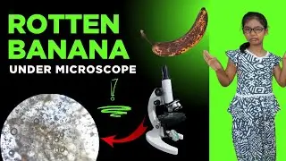 Rotten Banana Under the Microscope &ndash; Shocking Close-Up! 🍌🔬