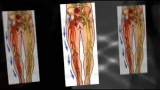 Ventura Sciatica Pain Relief, Ventura Chiropractor