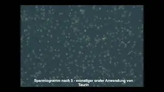 Spermiogramm nach Taurin  Einnahme