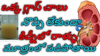 banana stem juice||how to make banana stem juice||home remedy for kidney stones.