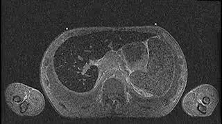 MRI Scans of a Korean Man