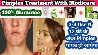 Modicare Pimples Treatment 3-4 Use मे और Pimples का आना बंद/100℅Gurantee/Lovely Get Fresh