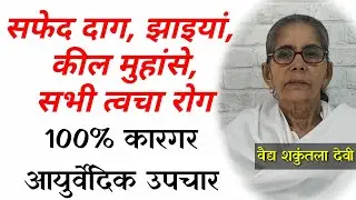 Ayurvedic Treatment for Hyperpigmentation, Psoriasis, Vitiligo and other skin disease.
