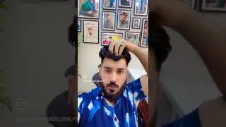 Permanent Hair Patch Delhi | Hair Wigs For Mens | Call : 9650914665
