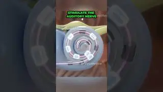 Как работают кохлеарные импланты (3D-анимация)