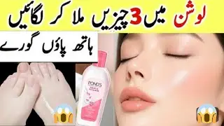 Secret whitening cream to remove Dark skin pigmentation wrinkles& dark spot|DIY Winter lotion cream 