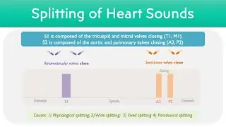 Splitting of Heart Sounds | S2 Splitting