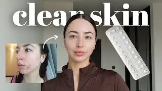How I cleared my acne holistically coming off the pill (no Roaccutane)