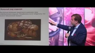 Андрей Длигач, Advanter Group, iForum-2017