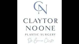 Deep Face and Neck Lift at 70: Just ONE Day Later! | Post-Op Recovery Update