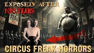 The Forgotten Circus Freaks History Tried to Erase