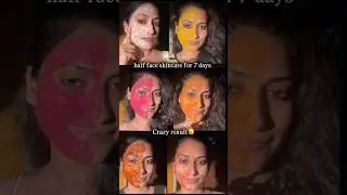 I applied 7 facemask on half face for 7 days😮😮#shorts #skincare #glassskin #facemask #brighterskin