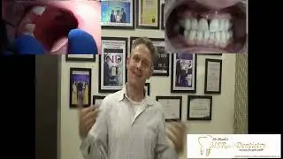 Tooth in a Day / #Frontteethreplacement with #dentalimplant / German Patient Review #Drvivekpandian