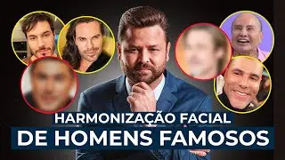 ANTES E DEPOIS DOS FAMOSOS – Analisando harmonização facial masculina | Dr Vitor Erlacher