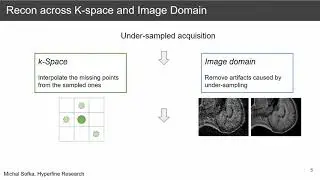 Deep MR image reconstruction across k-space and image domain. Michal Sofka, PhD