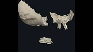 esfenoides, atlas y occipital
