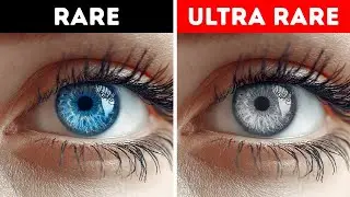 The Truth About Gray Eyes &mdash; And Other Rare Body Features You Might Have