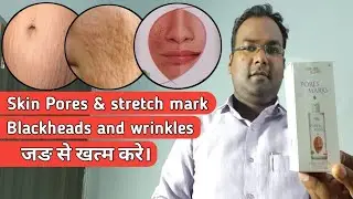 Nature Sure Pores and Marks oil review/How to get rid large pores.