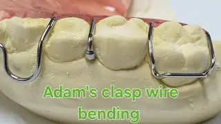 adams clasp bending/ Orthodontic retainer