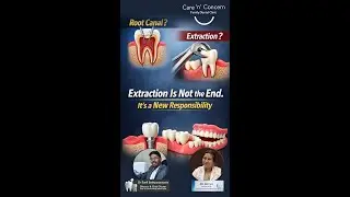 Root canal or extraction? 🤔After Extraction, What You Do Next Matters Most 🦷