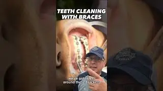 Teeth Cleaning with Braces Tip | In Office to Hands On Dental Training #shorts