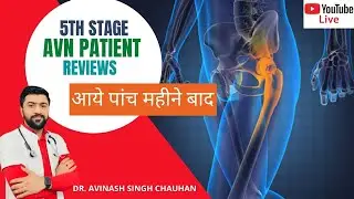 Last stage AVN patient review after 5 months treatment