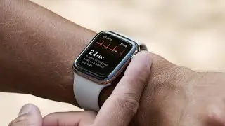 Apple Watch Users In South Korea and Russia Started Receiving ECG and heart rhythm notification