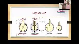 Сурфактант I LISA I INSURE I BPD I NICU I Neonatologist