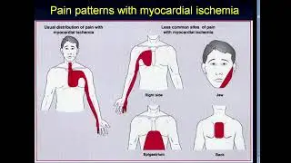 9:50-11:20 Coronary Artery Disease