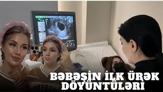 BƏBƏŞİN İLK ÜRƏK DOYÜNTÜLƏRİ 😍AD GÜNÜNƏ BİRLİKDƏ HAZIRLAŞAQ MAKEUP VLOĞ 🌸