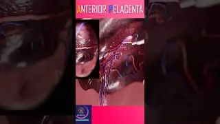 Placenta Examination #shorts
