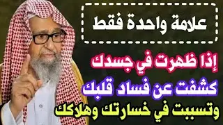 علامة واحدة فقط إذا ظهرت في جسدك كشفت عن فساد قلبك وحياتك كلها وتسببت في هلاكك وخسارتك/صالح الفوزان
