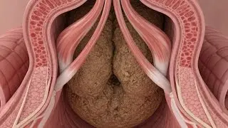 Constipation in The Gut Anatomy Explained is live