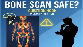 Bone Scan Test &ndash; Everything You Need to Know | Nuclear Medicine Explained