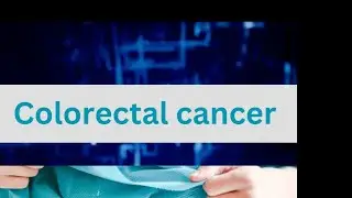 3D Animation Video of Colorectal cancer #healthcare #surgicalprocedure #shorts