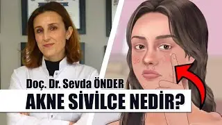 Sivilce (Akne) Nasıl Oluşur?  | Sivilce (Akne) Tedavisi Nasıl Yapılır? | Doç. Dr. Sevda ÖNDER.