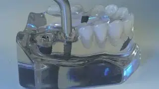 Saiba + FGM | Ativa&ccedil;&atilde;o do componente com o Martelete Arcsys