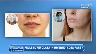 Pelle screpolata in inverno: cosa fare? Freddo e mascherine: come proteggere il viso