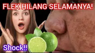 GOSOK SECARA RUTIN FLEKHITAM HILANG SELAMANYA 