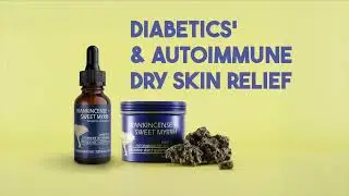 Frankincense & Myrrh Foot Healing Cream | Deep Nourishment for Dry & Diabetic Skin