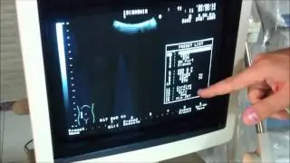 Aloka SSD-1000 preset menu part 2