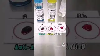 Определение группы крови шаг за шагом #лаборатория #медтехник #студентмедтехника #mls #mt #банккрови