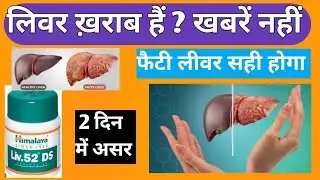Liv 52 ds use  | liv 52 use  | best liver tonic | liver syrup |fatty liver best dawa 