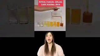 WARNA URINE INI PERTANDA GAGAL GINJAL⁉️#edukasi #edukasikesehatan #urine #gagalginjal #anak #dokter
