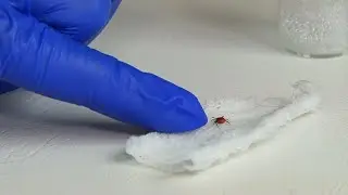 Диагноз клещевой энцефалит подтвердили почти у шестидесяти жителей Иркутской области